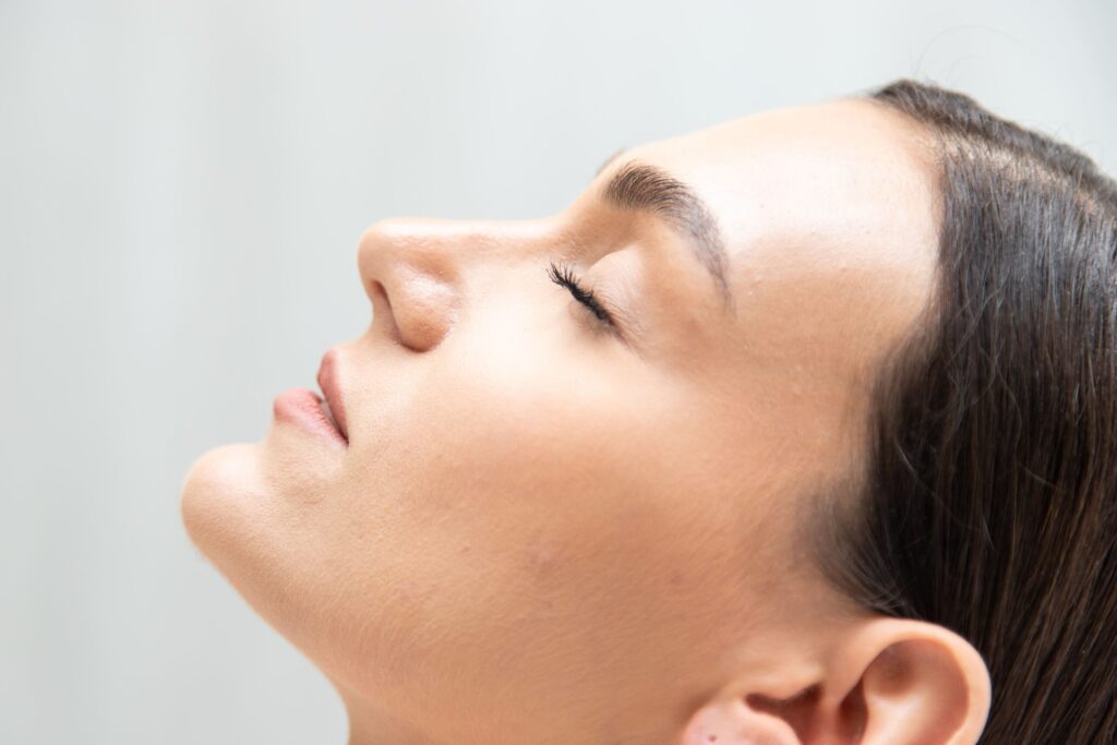 Biostimuliacija_Radiesse